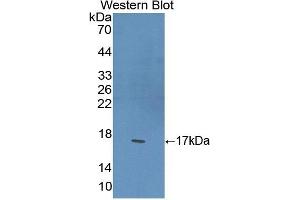 Detection of Recombinant PPARg, Mouse using Polyclonal Antibody to Peroxisome Proliferator Activated Receptor Gamma (PPARg) (PPARG antibody  (AA 149-273))