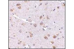 Immunohistochemistry of SATB1 in human brain with this product at 5 μg/ml. (SATB1 antibody  (C-Term))