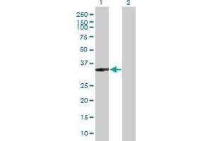 Western Blot analysis of XRCC2 expression in transfected 293T cell line by XRCC2 MaxPab polyclonal antibody. (XRCC2 antibody  (AA 1-280))