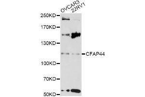 Western blot analysis of extracts of various cell lines, using CFAP44 antibody (ABIN6290455) at 1:3000 dilution. (WDR52 antibody)
