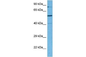 Western Blotting (WB) image for anti-SWI/SNF Related, Matrix Associated, Actin Dependent Regulator of Chromatin, Subfamily D, Member 2 (SMARCD2) (C-Term) antibody (ABIN2780464)