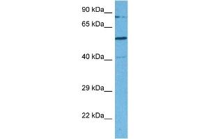 Host:  Rabbit  Target Name:  SMARCD2  Sample Tissue:  Human MDA-MB-435s Whole Cell  Antibody Dilution:  1ug/ml (SMARCD2 antibody  (C-Term))