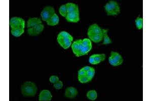 Immunofluorescence staining of MCF-7 cells with ABIN7174409 at 1:66, counter-stained with DAPI. (UBA52 antibody  (AA 1-128))