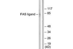 Western blot analysis of extracts from 293 cells, using FAS ligand Antibody. (FASL antibody  (AA 101-150))