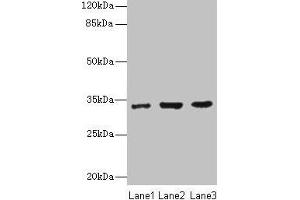 Western blot All lanes: NAPA antibody at 7 μg/mL Lane 1: 293T whole cell lysate Lane 2: Hela whole cell lysate Lane 3: K562 whole cell lysate Secondary Goat polyclonal to rabbit IgG at 1/10000 dilution Predicted band size: 34 kDa Observed band size: 34 kDa (NAPA antibody  (AA 1-295))
