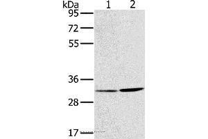 Western blot analysis of A172 and A375 cell, using HSD17B12 Polyclonal Antibody at dilution of 1:650