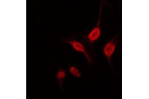 ABIN6266920 staining 293 by IF/ICC. (NEUROD2 antibody  (Internal Region))