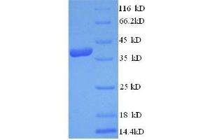 SDS-PAGE (SDS) image for Annexin A1 (ANXA1) (AA 5-346), (partial) protein (His tag) (ABIN1046548)