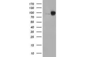 HEK293T cells were transfected with the pCMV6-ENTRY control (Left lane) or pCMV6-ENTRY CTNNB1 (Right lane) cDNA for 48 hrs and lysed. (CTNNB1 antibody)