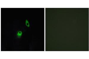 Immunofluorescence analysis of HeLa cells, using GPR124 antibody. (GPR124 antibody  (C-Term))