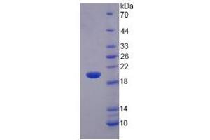 SDS-PAGE analysis of Rat Matrix Metalloproteinase 3 (MMP3) Protein.