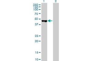 Western Blot analysis of PCYT2 expression in transfected 293T cell line by PCYT2 MaxPab polyclonal antibody. (PCYT2 antibody  (AA 1-389))