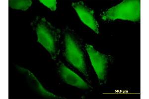 Immunofluorescence of monoclonal antibody to IBRDC1 on HepG2 cell. (RNF217 antibody  (AA 2-100))