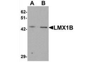 Western blot analysis of LMX1B in A-20 cell lysate with LMX1B Antibody  at (A) 1 and (B) 2 μg/mL