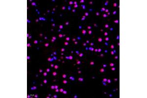 Immunofluorescence of paraffin embedded mouse brain using RBAK (ABIN7075383) at dilution of 1:400 (400x lens) (RBAK antibody)