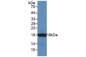 Detection of Recombinant SST, Mouse using Monoclonal Antibody to Somatostatin (SST) (Somatostatin antibody  (AA 27-116))