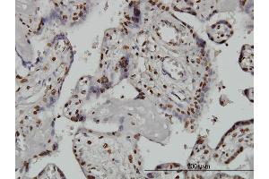 Immunoperoxidase of monoclonal antibody to ARID1B on formalin-fixed paraffin-embedded human placenta. (ARID1B antibody  (AA 1364-1460))