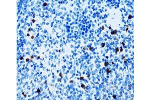 Immunohistochemistry of paraffin-embedded Mouse spleen using SPN Polyclonal Antibody at dilution of 1:100 (40x lens). (CD43 antibody)