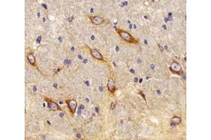 IHC analysis of FFPE rat brain using CB2 antibody at 1:25.