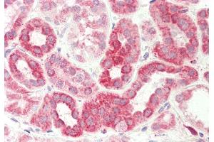 Rabbit Anti-DLST antibody Catalog Number: ARP61476 Formalin Fixed Paraffin Embedded Tissue: Human Kidney Primary antibody Concentration: 1:200 Secondary Antibody: Donkey anti-Rabbit-Cy3 Secondary Antibody Concentration: 1:200 Magnification: 20x Exposure Time: 0. (DLST antibody  (C-Term))