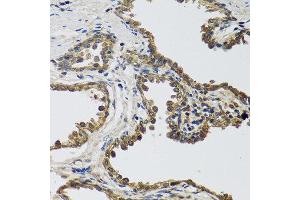 Immunohistochemistry of paraffin-embedded human prostate using IL25 antibody at dilution of 1:100 (40x lens). (IL-25 antibody)