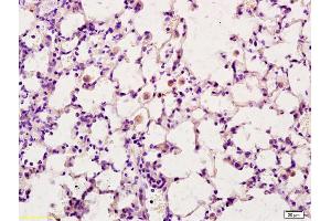 CD163L1 antibody  (AA 1001-1100)