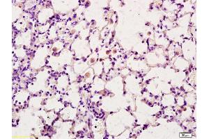 Formalin-fixed and paraffin embedded rat brain tissue labeled with Anti-CD163L1 Polyclonal Antibody, Unconjugated at 1:200, followed by conjugation to the secondary antibody and DAB staining (CD163L1 antibody  (AA 1001-1100))