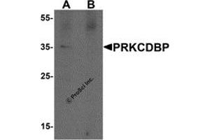 Western Blotting (WB) image for anti-Protein Kinase C, delta Binding Protein (PRKCDBP) antibody (ABIN1077454) (PRKCDBP antibody)