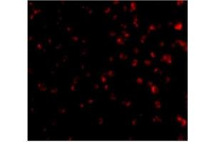 Immunofluorescence of TIM-4 in Jurkat cells with TIM-4 antibody at 20 µg/ml. (TIMD4 antibody  (Center))