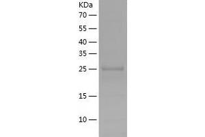 Western Blotting (WB) image for phosphoglycerate Mutase 1 (Brain) (PGAM1) (AA 1-254) protein (His tag) (ABIN7288713) (PGAM1 Protein (AA 1-254) (His tag))