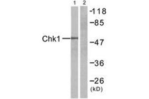 Western blot analysis of extracts from HT-29 cells, treated with UV, using Chk1 (Ab-345) Antibody. (CHEK1 antibody  (AA 310-359))