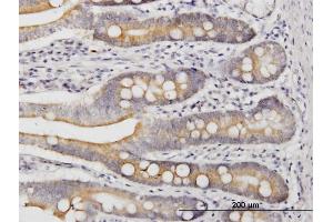 Immunoperoxidase of monoclonal antibody to LIAS on formalin-fixed paraffin-embedded human small Intestine. (LIAS antibody  (AA 273-372))