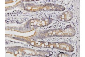 Immunoperoxidase of monoclonal antibody to LIAS on formalin-fixed paraffin-embedded human small Intestine.