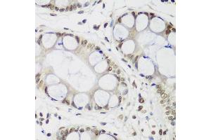 Immunohistochemistry of paraffin-embedded human gastric using CBX3 antibody. (CBX3 antibody)