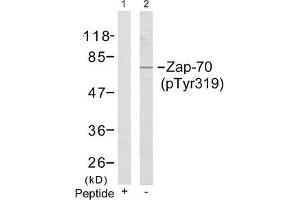 Western blot analysis of extracts from Jurkat cells using Zap-70(Phospho-Tyr319) Antibody(Lane 2) and the same antibody preincubated with blocking peptide(Lane1). (ZAP7 (pTyr319) antibody)