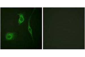 Immunofluorescence (IF) image for anti-Heat Shock Protein, alpha-Crystallin-Related, B6 (HSPB6) (AA 5-54), (pSer16) antibody (ABIN1531324)