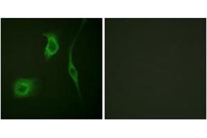 Immunofluorescence analysis of HeLa cells, using HSP20 (Phospho-Ser16) Antibody. (HSPB6 antibody  (pSer16))