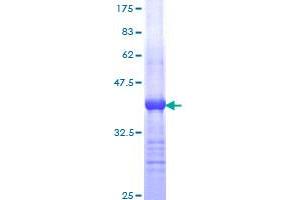 HDAC6 Protein (AA 1128-1215) (GST tag)