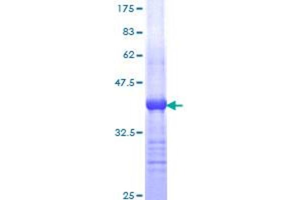 HDAC6 Protein (AA 1128-1215) (GST tag)