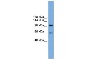 WB Suggested Anti-EXOC6 Antibody Titration: 0. (EXOC6 antibody  (Middle Region))