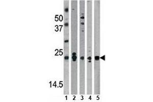 Western Blotting (WB) image for anti-Parkinson Protein 7 (PARK7) (AA 1-30) antibody (ABIN3032158)