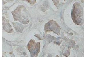 Immunohistochemical staining of formalin-fixed paraffin-embedded human pancreas tissue showing cytoplasmic staining with CARD6 polyclonal antibody  at 1 : 100 dilution. (CARD6 antibody  (C-Term))