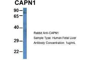 Host: Rabbit  Target Name: CAPN1  Sample Tissue: Human Fetal Liver  Antibody Dilution: 1. (CAPNL1 antibody  (N-Term))