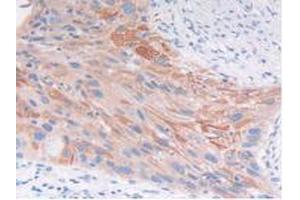 IHC-P analysis of Human Lung Tissue, with DAB staining. (FGFRL1 antibody  (AA 168-378))