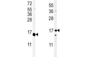 (Left) Western blot analysis of IL-4 antibody and WiDr lysate; (Right) Western blot analysis of IL-4 antibody and mouse cerebellum lysate (IL-4 antibody  (AA 122-150))