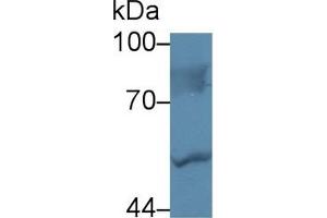 Detection of LBP in Human Hela cell lysate using Polyclonal Antibody to Lipopolysaccharide Binding Protein (LBP) (LBP antibody  (AA 224-468))
