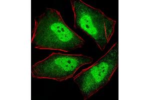 Fluorescent image of Hela cells stained with XAF1 PS Antibody (ABIN1539887 and ABIN2843849).