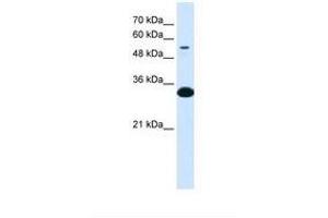 Image no. 1 for anti-alpha-1-B Glycoprotein (A1BG) (AA 129-178) antibody (ABIN324339) (A1BG antibody  (AA 129-178))