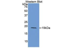 Western blot analysis of the recombinant protein. (IL-15 antibody  (AA 49-162))