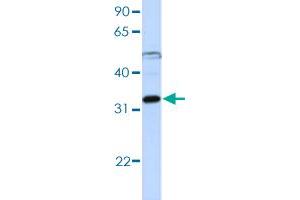 Western blot analysis of Jurkat cell lysate with EIF3G polyclonal antibody . (EIF3G antibody  (AA 218-267))